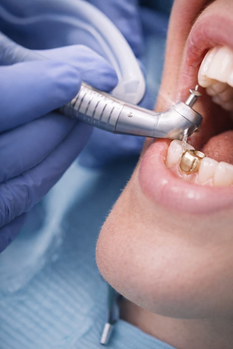 Restorative dentistry tools in a modern clinic